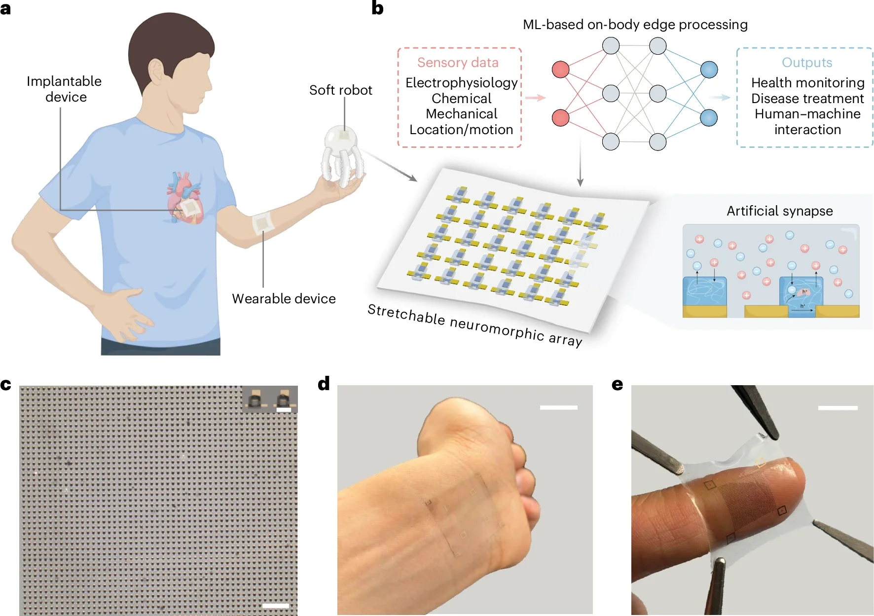 Future Trends in AI Skin Patches - contextual illustration