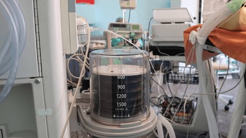 Enter the Custom Engineered Solution - visual representation