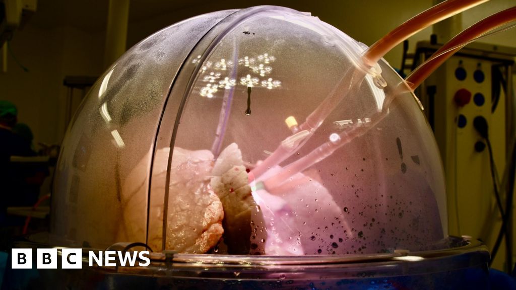 The Future of Acute Respiratory Failure Treatment - visual representation