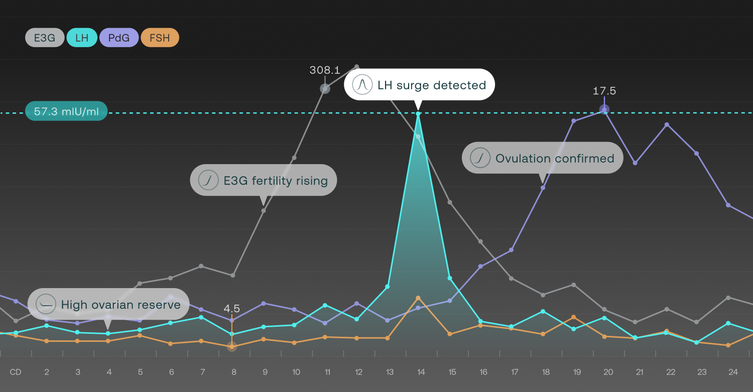 How the Mira Ultra 4 Actually Works - visual representation