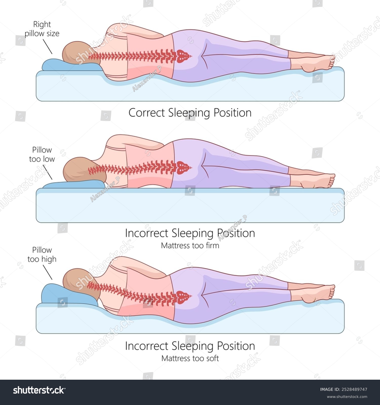 The Best Body Pillow for Most People: Snuggle-Pedic - visual representation