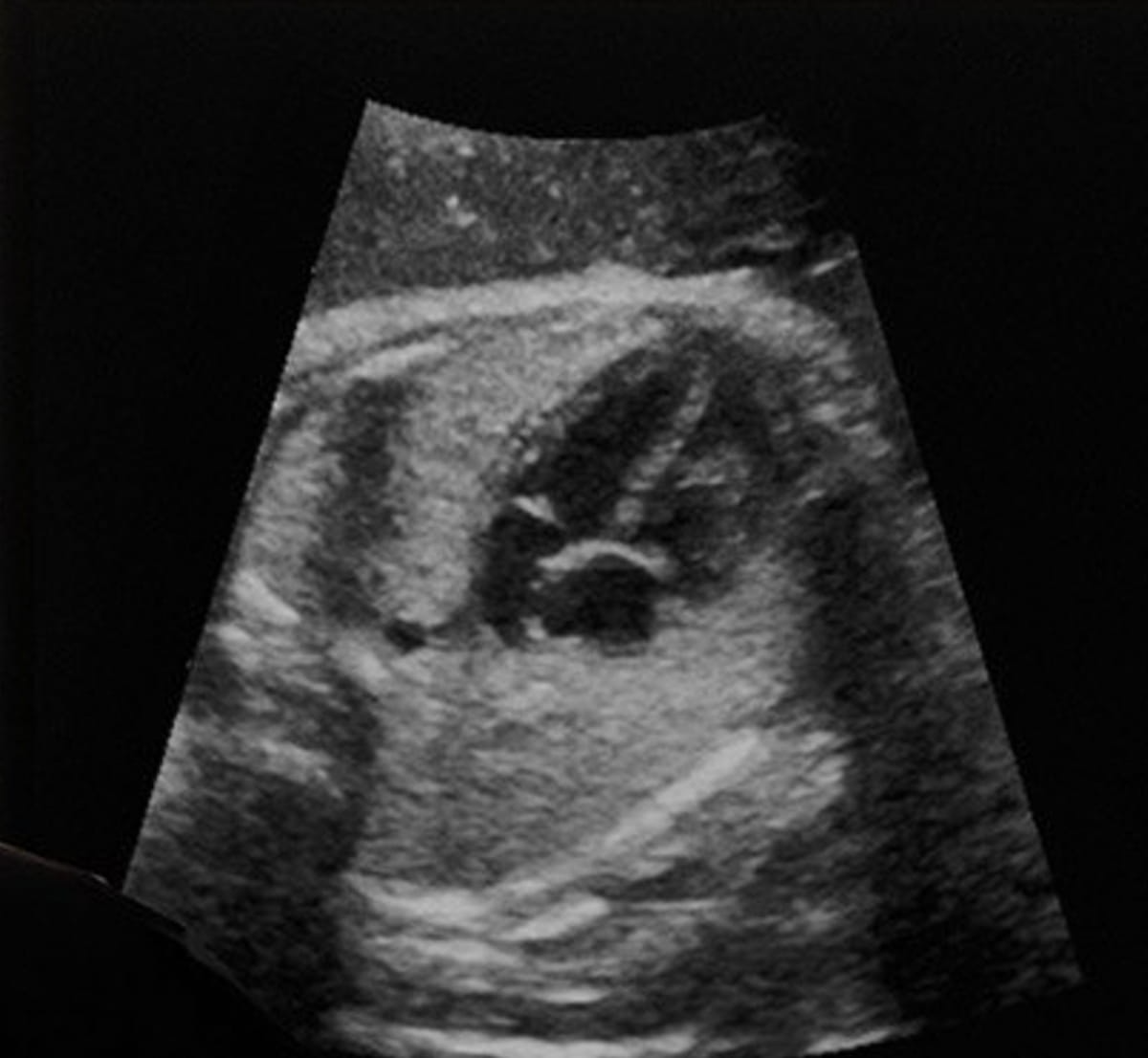 Implementation Considerations for Healthcare Systems - visual representation