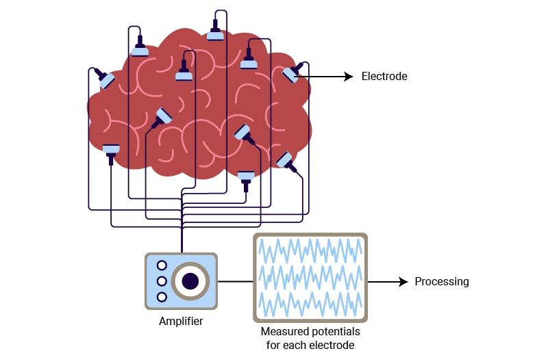 Funding Context: What $5M Means for Runway and Growth - visual representation