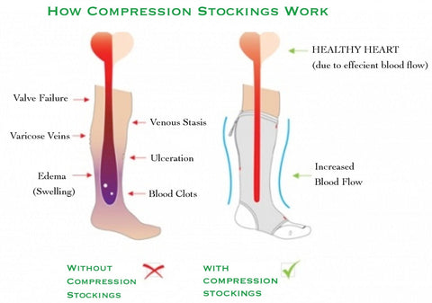A Brief History of Athletic Socks - visual representation