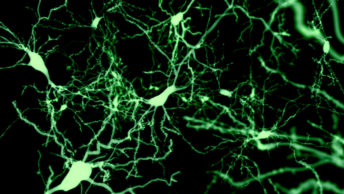 Finding the cells that put our brain to sleep - Ars Technica
