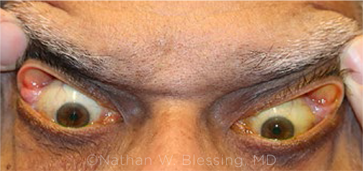 The Bigger Picture: How Rare Symptoms Reveal Common Diseases - visual representation