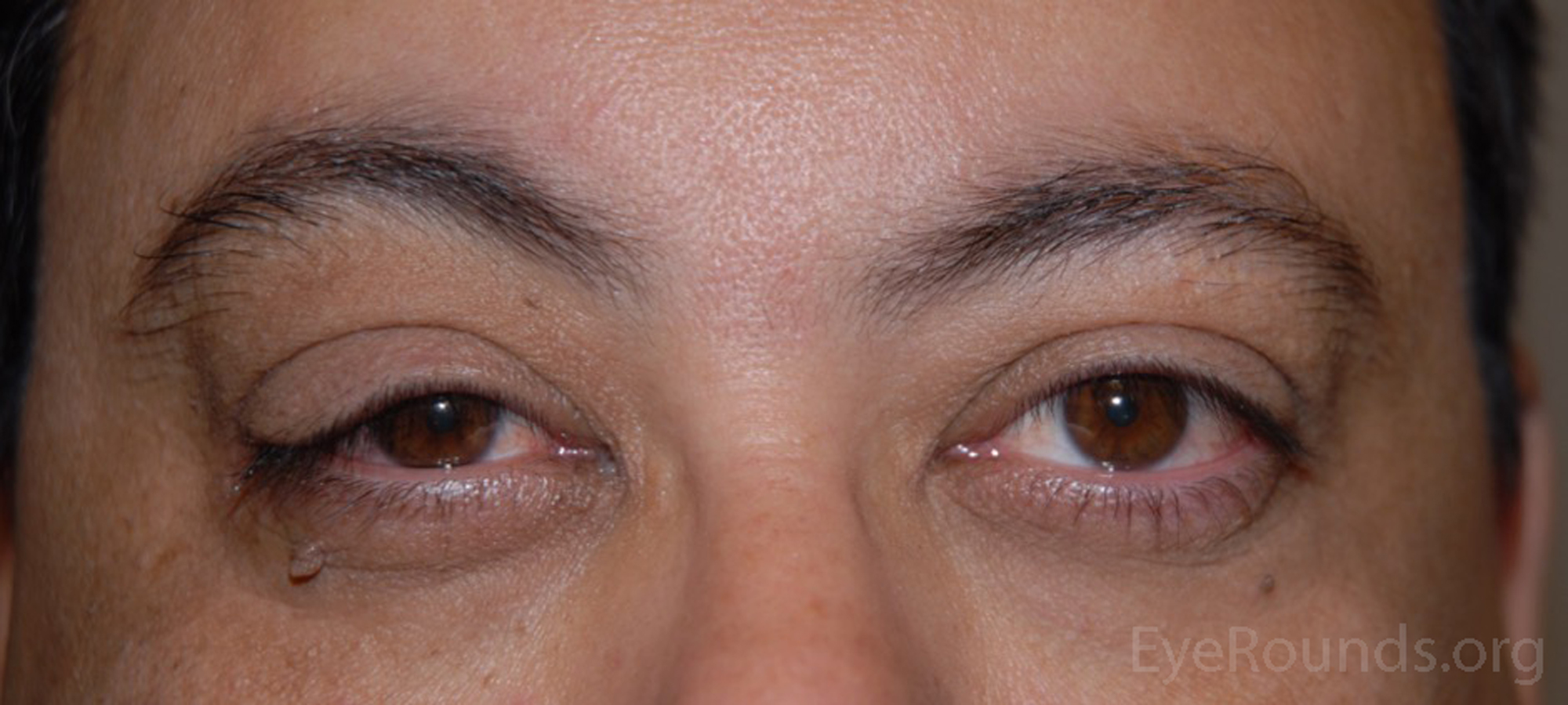 Conclusion: The Simple Power of Proper Sleep - visual representation