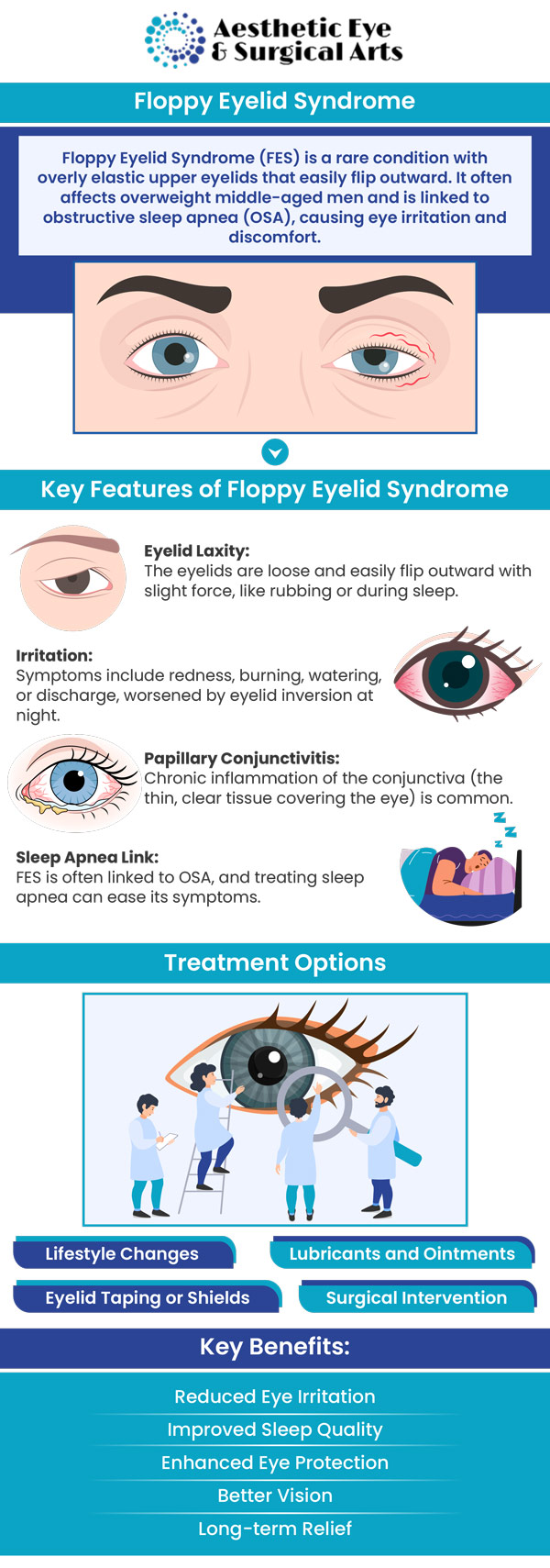 Understanding Floppy Eyelid Syndrome: Definition and Symptoms - contextual illustration