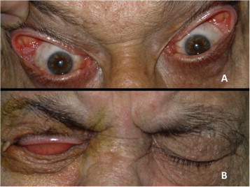 Treatment Approaches: From Conservative Management to CPAP - visual representation