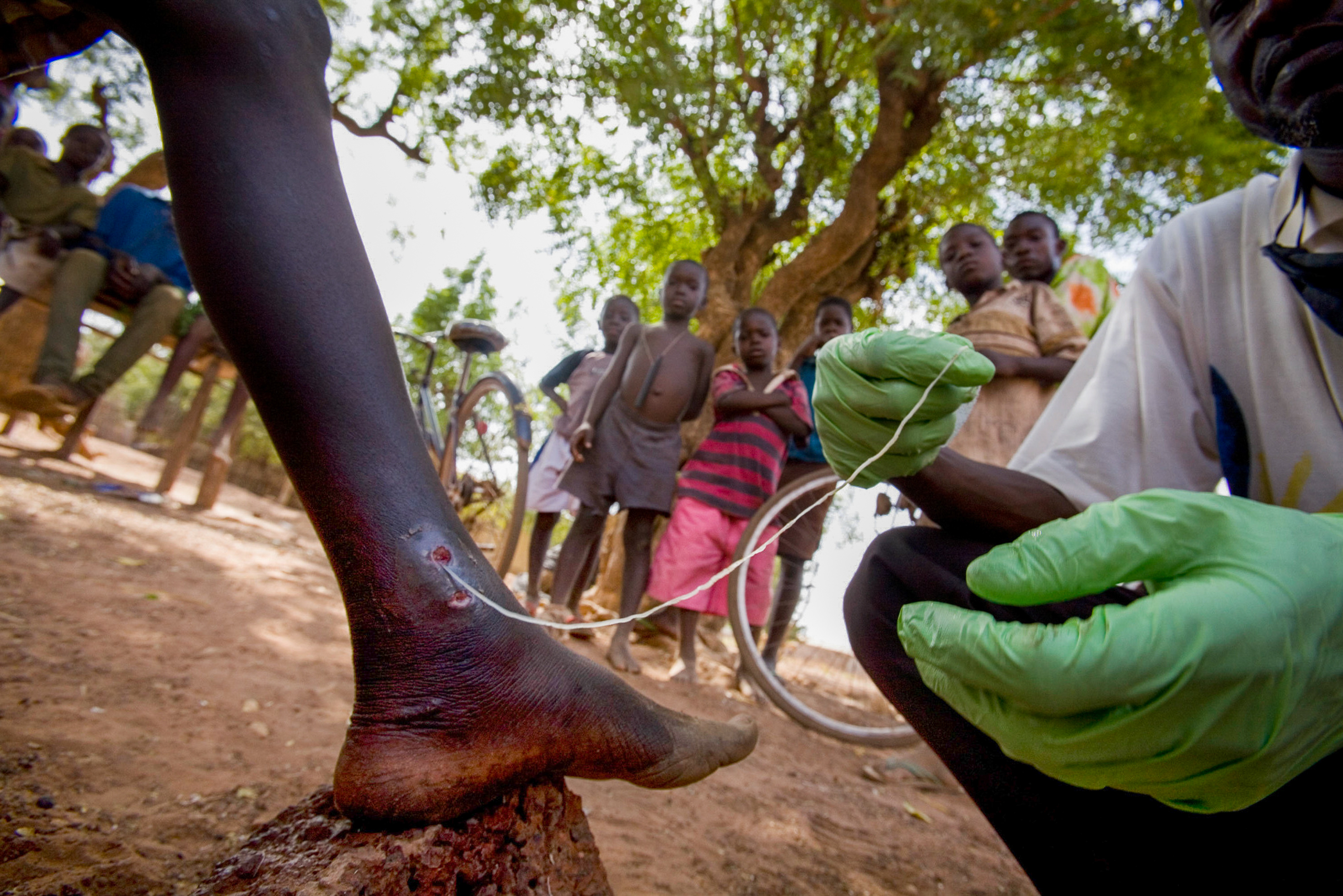 Lessons from Guinea Worm for Other Eradication Efforts - visual representation