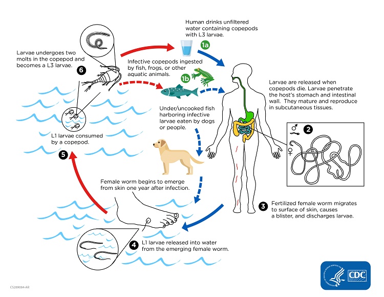 The Biology of Suffering: How Guinea Worm Infects and Damages - contextual illustration