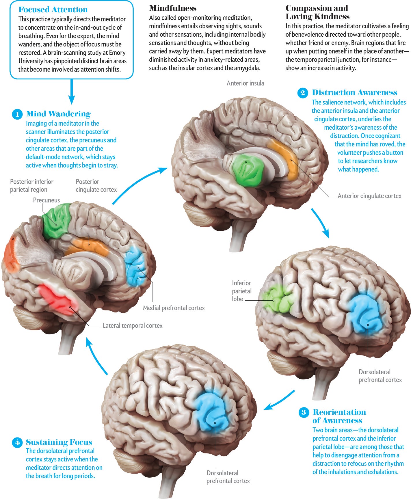 Neuroplasticity: How Meditation Physically Rewires the Brain - visual representation