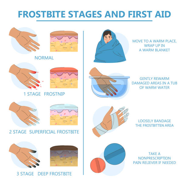 Practical Implementation of FROST - contextual illustration