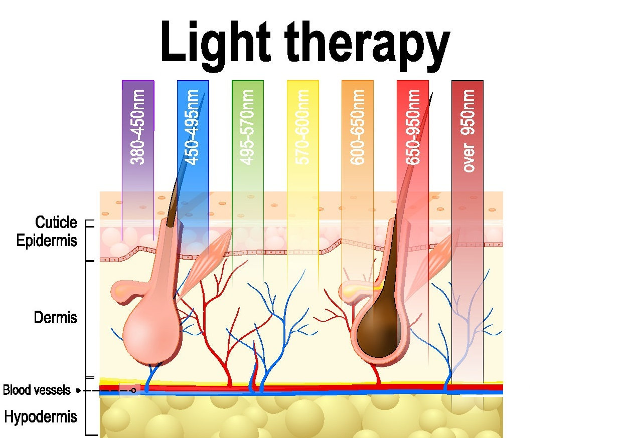 TL; DR - visual representation