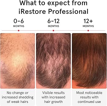 The iRestore Elite: Hardware, Design, and Build Quality - visual representation