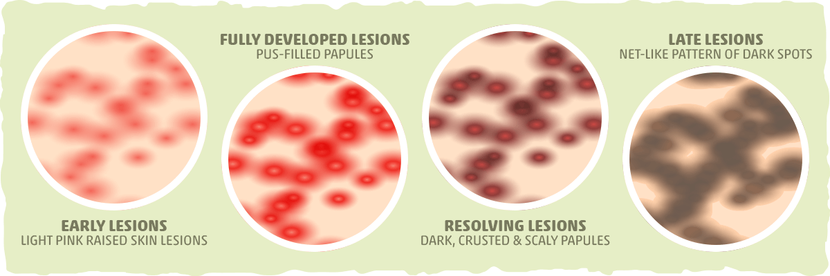 Prevention Strategies for People Considering Ketosis - visual representation