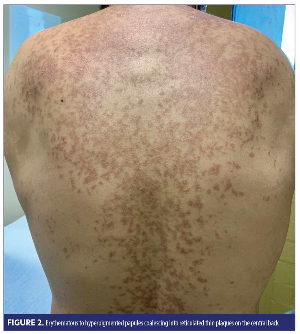 The Treatment That Actually Works: Tetracyclines - visual representation
