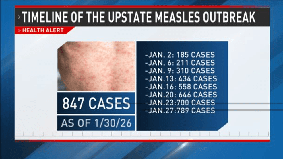 TL; DR - visual representation