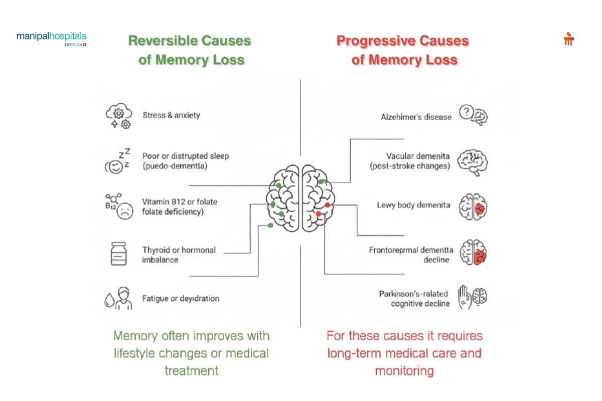 Causes of the Memory Shortage - contextual illustration
