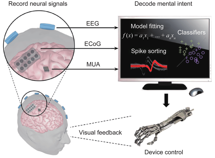 The Ultrasound Breakthrough: How It Works Without Drilling Into Your Brain - contextual illustration