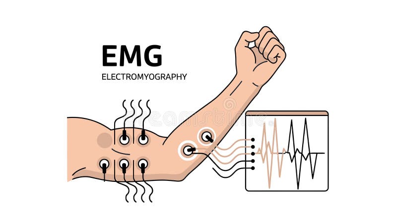 EMG Handwriting: Writing Without a Keyboard - contextual illustration