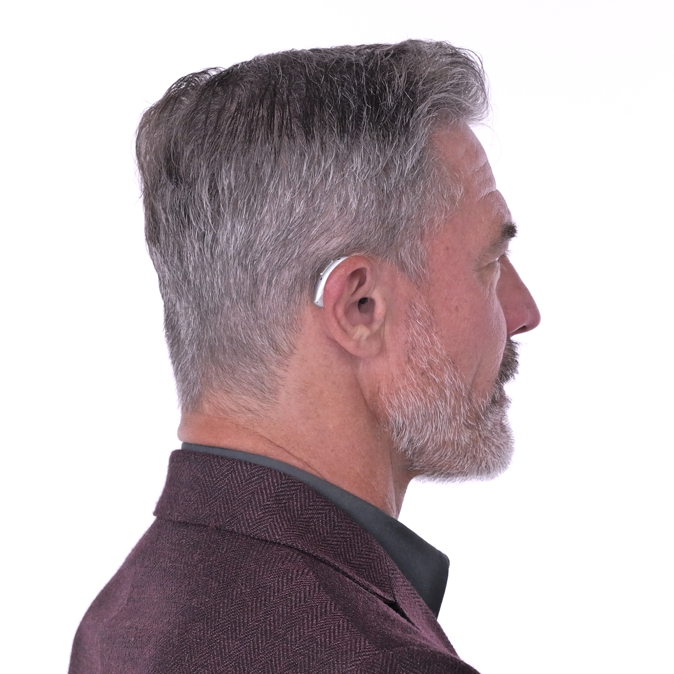 Understanding When the Phonak Audeo Infinio Ultra Sphere Makes Sense - visual representation