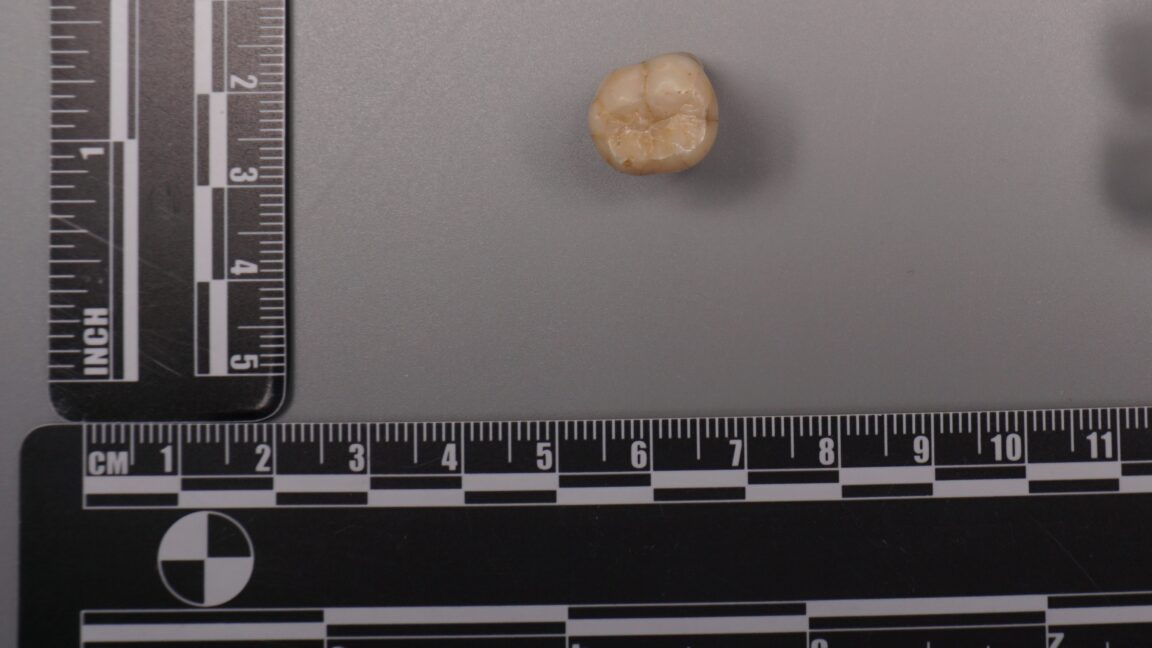 Protein in Homo erectus teeth suggests Denisovans gave us some of their DNA - Ars Technica