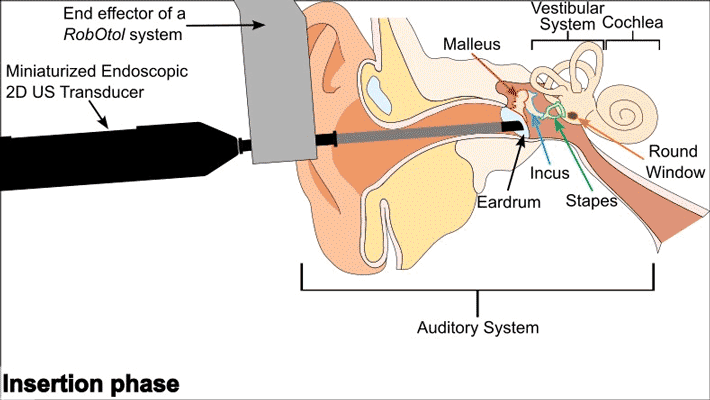 Why Size Became an Obsession in Audio Design - contextual illustration