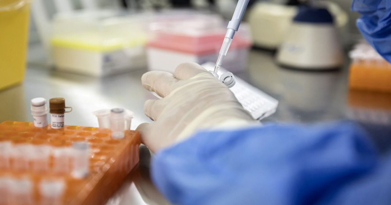Supercharging Immune Cells May Help Control HIV Long-Term | WIRED
