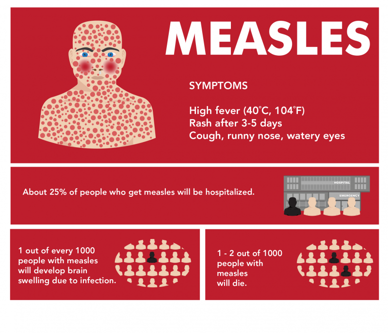 The Impact of Measles Outbreaks - contextual illustration