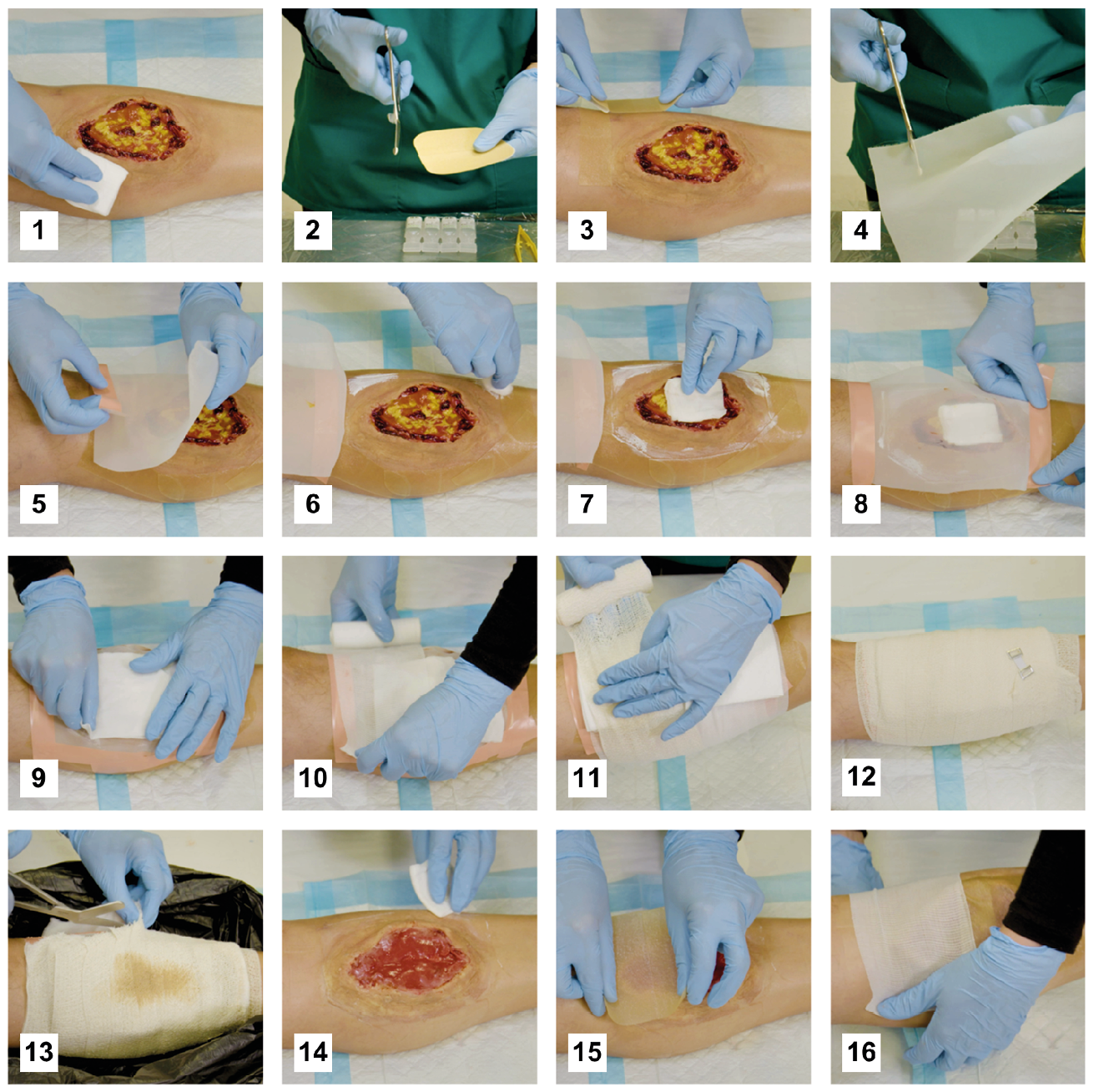 Clinical Applications of Maggot Therapy - visual representation