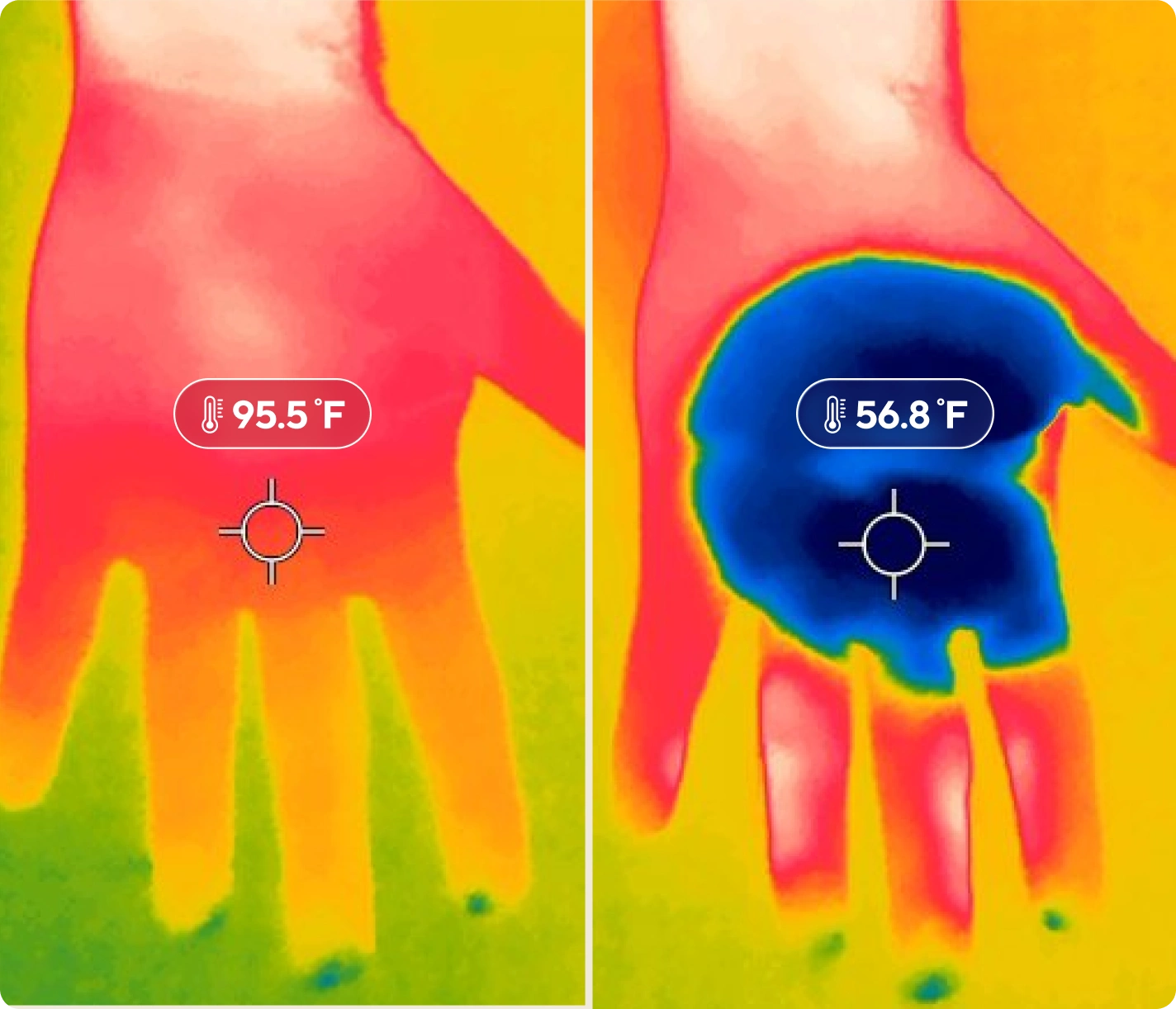 How Cryo Therm Palm Works - visual representation