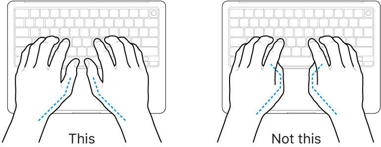 Why Users Are Filing Down Their MacBooks - visual representation