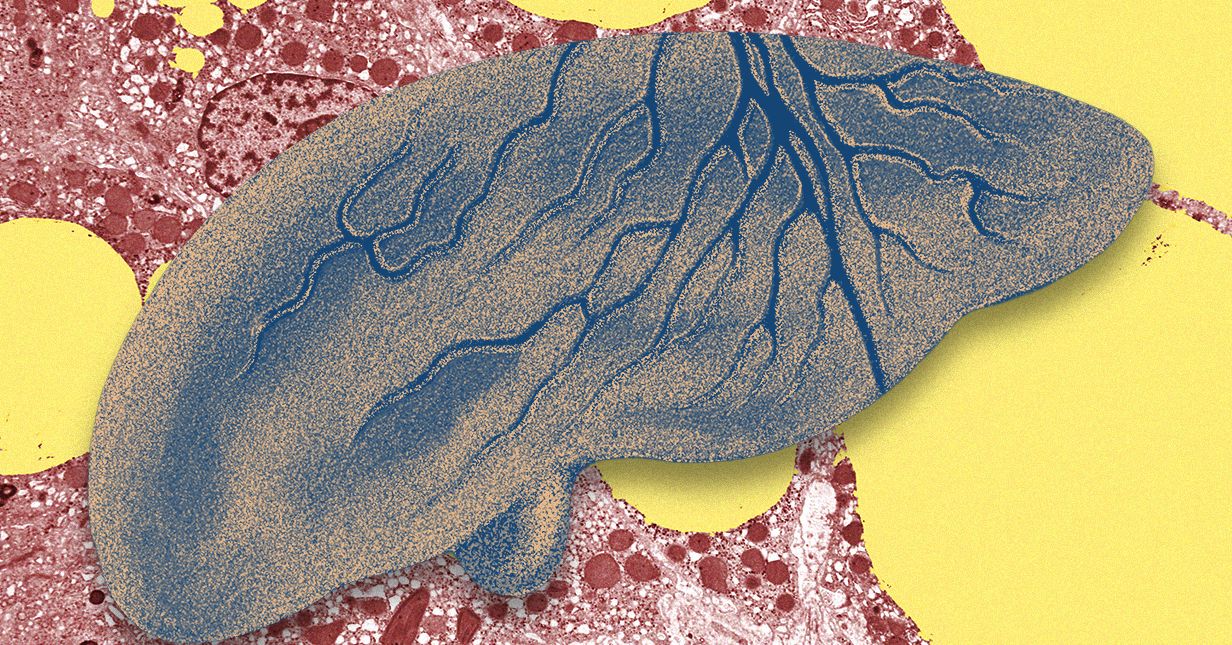 There’s a Fatty Liver Epidemic. AI Could Help Get Ahead of It | WIRED