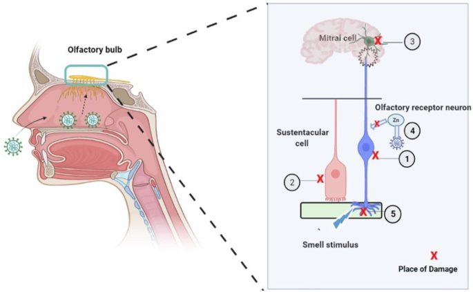 Diagnosing Anosmia - contextual illustration