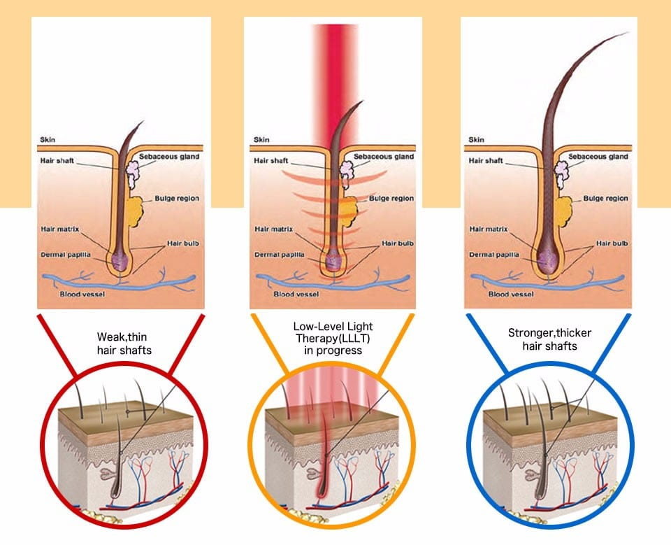 Understanding At-Home Hair Growth Systems - visual representation
