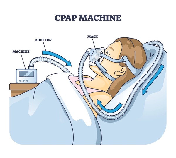 The Importance of Early Detection - visual representation