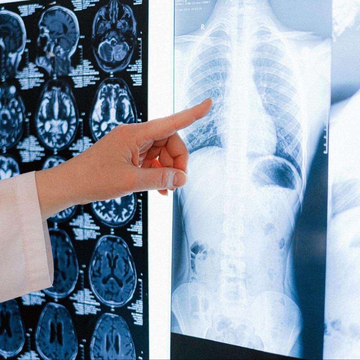 What The Radiologist's Perspective Reveals - visual representation