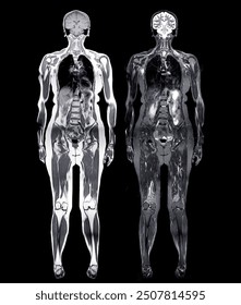 What Exactly Is Elective Whole-Body MRI Screening? - visual representation