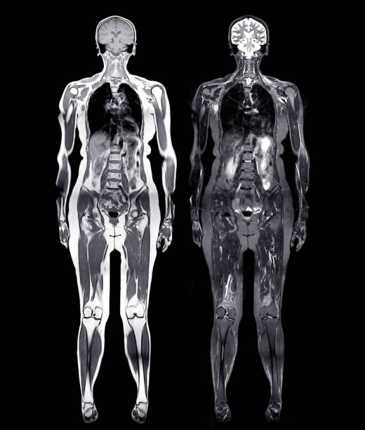 Why Do Whole-Body Scans Miss Important Findings? - visual representation