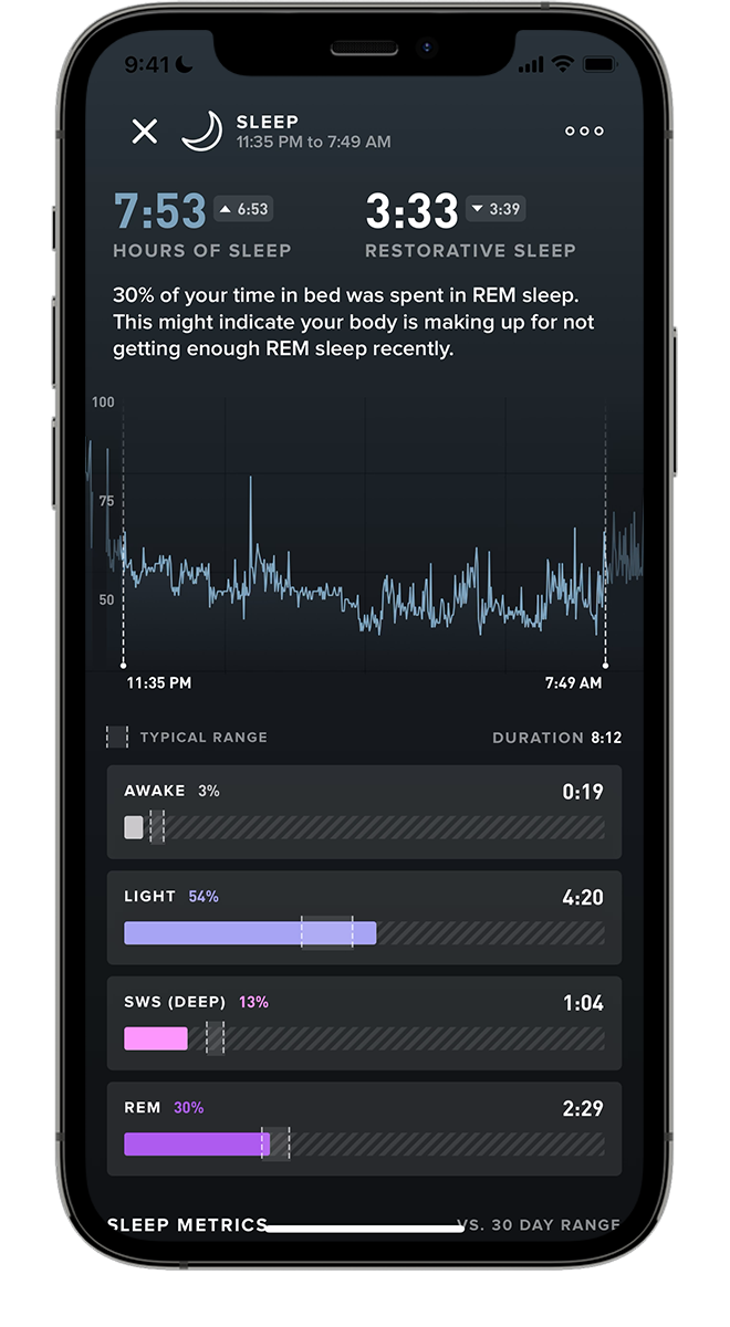 Why Choose Whoop Over Standard Fitness Trackers? - visual representation