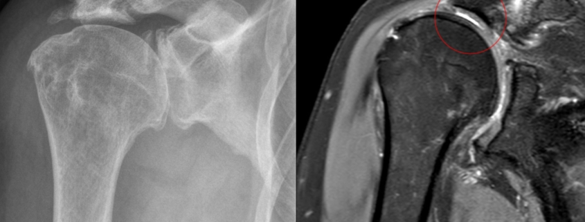Physical Therapy: The Evidence for Non-Surgical Management - visual representation
