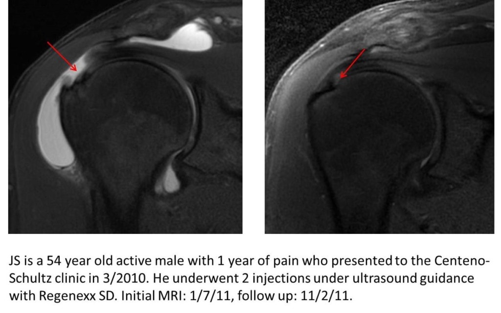 Red Flags: When MRI and Specialist Consultation Actually Are Needed - visual representation