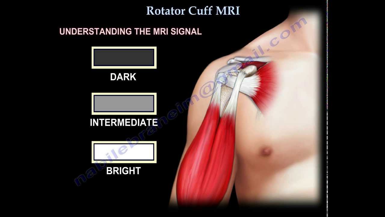 The Future of Shoulder Imaging: Moving Toward Appropriate Care - visual representation