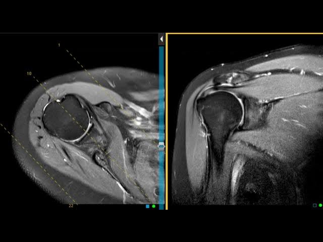 The Bigger Picture: When Imaging Becomes a Problem - visual representation