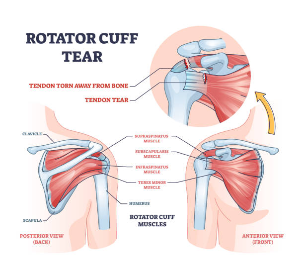 Understanding the Rotator Cuff: What It Actually Does - contextual illustration
