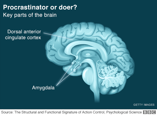 Final Thoughts: Your Brain Isn't Broken, Just Cautious - visual representation