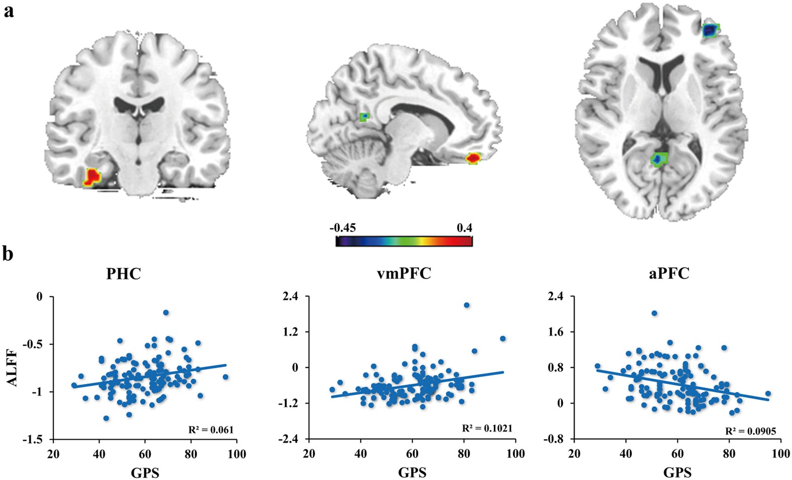 The Kyoto University Study: Mapping the Neural Circuit of Procrastination - contextual illustration