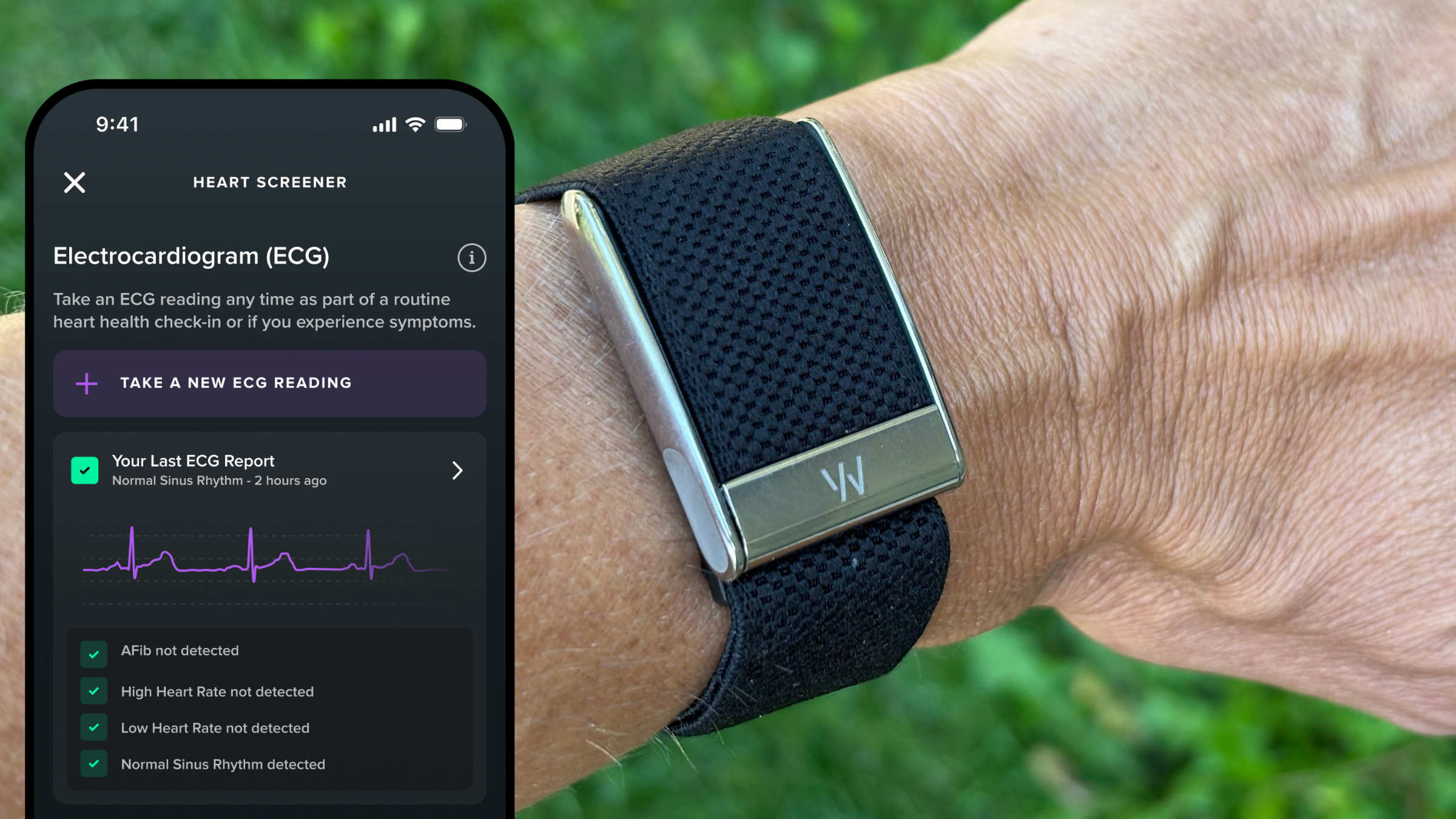 TL; DR - visual representation